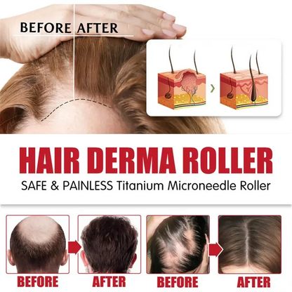 G Private Label Scalp Damaged Solution Nourish Roots Fast Grow Anti Hair Loss Serum