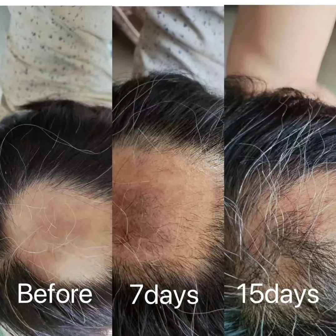 G Private Label Scalp Damaged Solution Nourish Roots Fast Grow Anti Hair Loss Serum