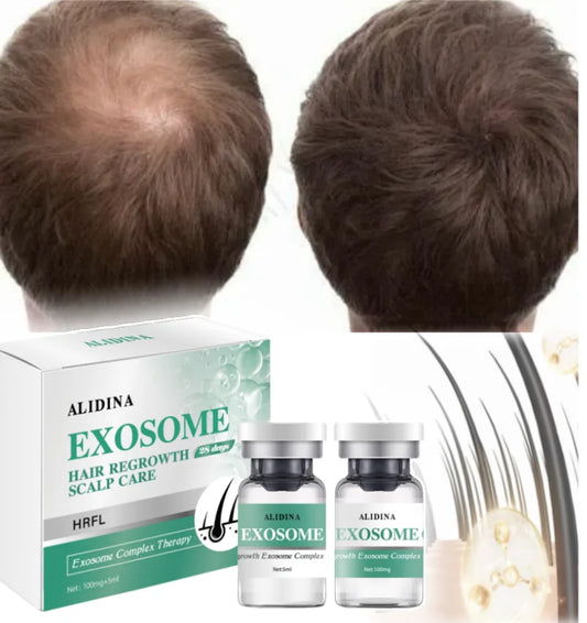 G Private Label Scalp Damaged Solution Nourish Roots Fast Grow Anti Hair Loss Serum