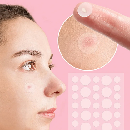 36pcs Face and Body Pimple Patches for Covering Pimples, Acne Patches or Zit Spots Stickers, Body Patches