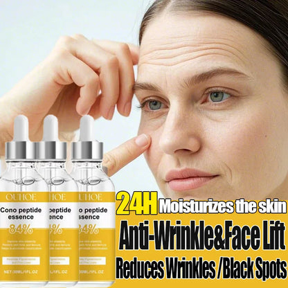 Anti Aging Facial Retinol Serum Improve Skin Alasticity Fade Fine Lines Firming Skin Shrink Pores Reduces Wrinkle Pigmentation