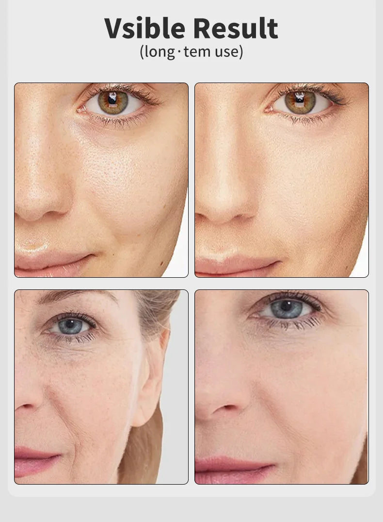 Electric Vibrating Age-R Booster Pro 7 Colors Led Facial Light Therapy Anti Wrinkle Brightening Beauty Device Rejuvenation Tool