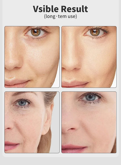 Electric Vibrating Age-R Booster Pro 7 Colors Led Facial Light Therapy Anti Wrinkle Brightening Beauty Device Rejuvenation Tool