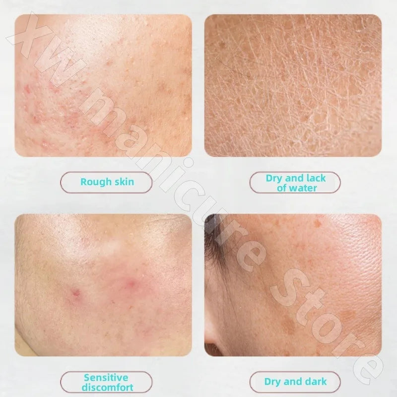 Kenta Cream Brightens Skin Tone Moisturizes Hydrating Repairs Sensitive Skin Improves Redness and Darkness 30g