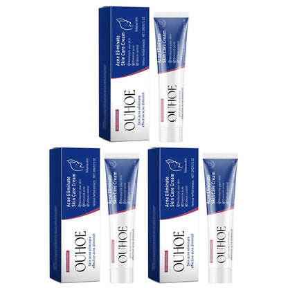 Pimple Acne Treatment Face Cream Nourish Balance Oil Control Refreshing Repairing Pimple Remover Acne Removing Cleansing Cream