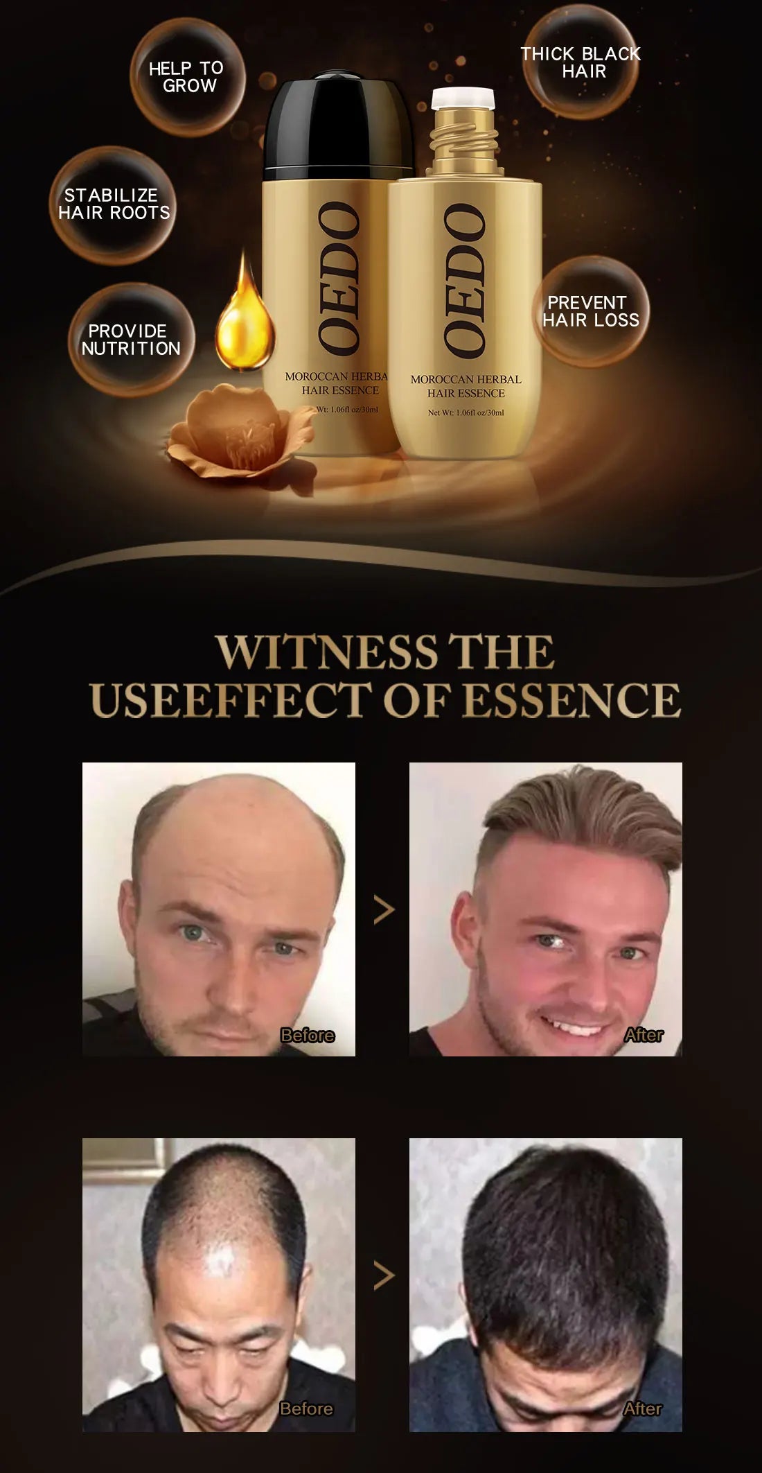 2PCS Ginseng Gloss Nourish Repair Hair Treatment Hair Loss Fast and Powerful Hair Growth Essence Hair Care