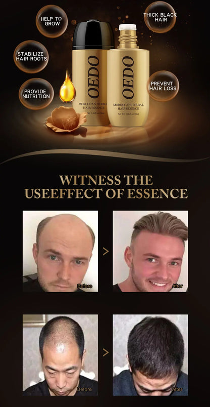 2PCS Ginseng Gloss Nourish Repair Hair Treatment Hair Loss Fast and Powerful Hair Growth Essence Hair Care