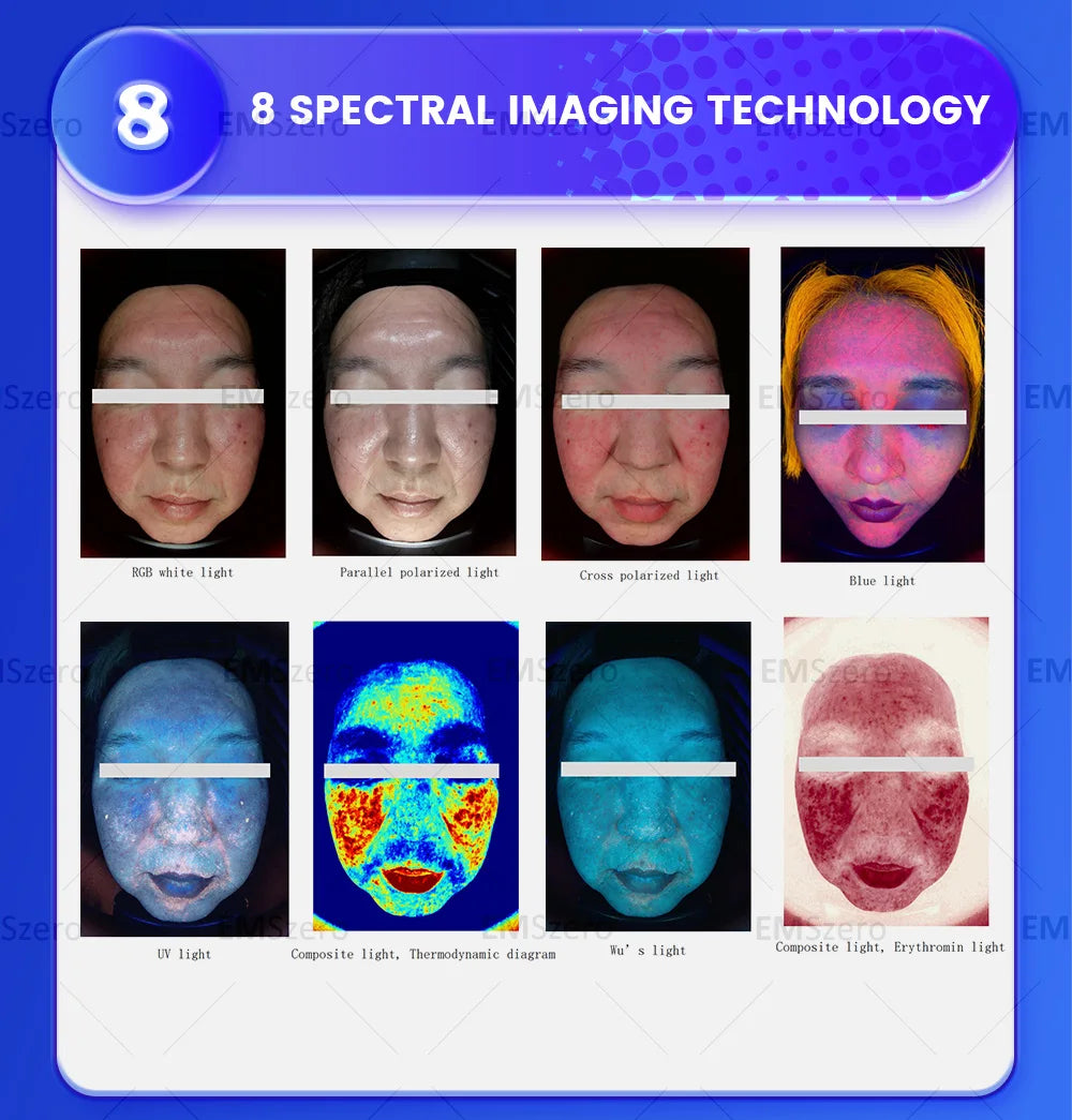 The best smart facial skin detection and analysis beauty instrument.Skin scan analysis anti-aging instrument