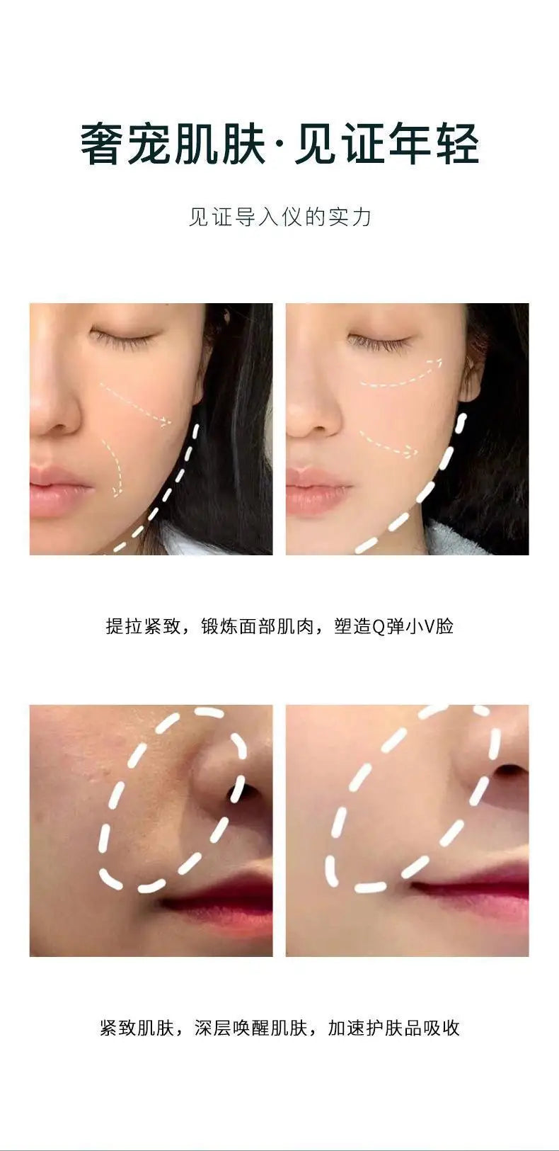 Electric Facial Beauty Devices Face Lifting Anti Wrinkle Facial Eye Massage with Face Cream Introducer Skin Rejuvenation
