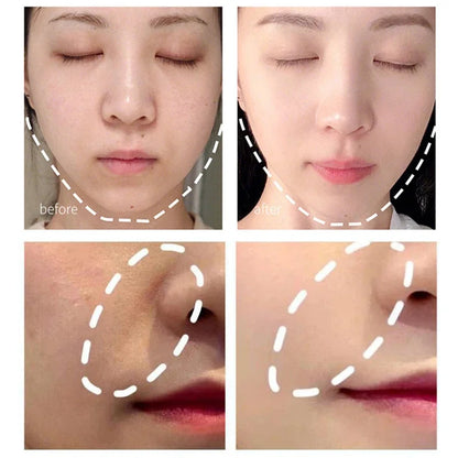 Electric Facial Beauty Devices Face Lifting Anti Wrinkle Facial Eye Massage with Face Cream Introducer Skin Rejuvenation